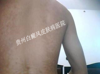 Ҫԭʲô