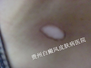 ¾ĲЩ